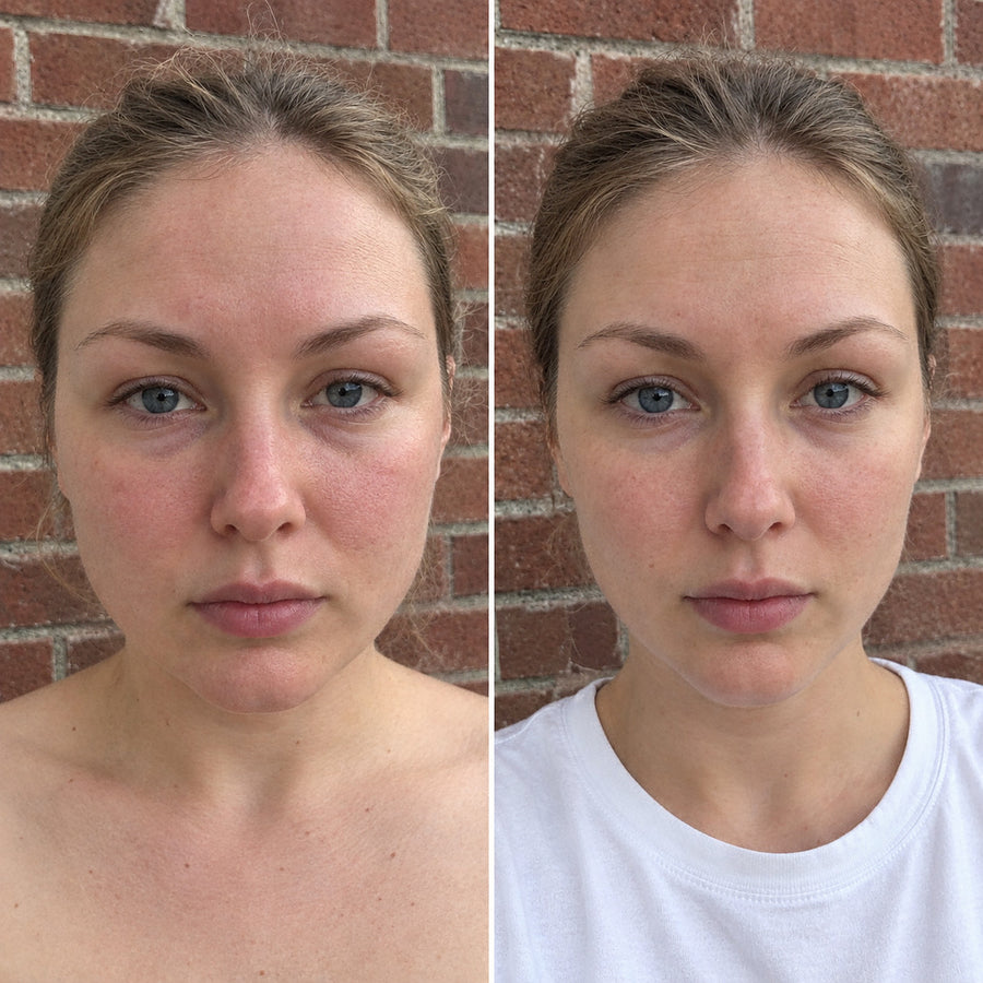 Utilisation de la brosse contour lymphatique